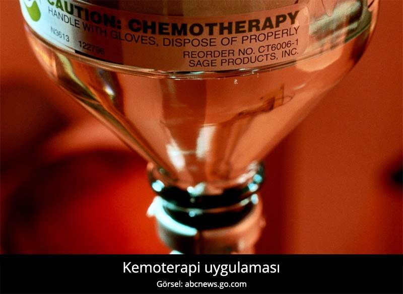 Kemoterapi - Prof. Dr. Çetin Vural