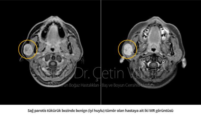 t-k-r-k-bezi-t-m-rleri-prof-dr-etin-vural